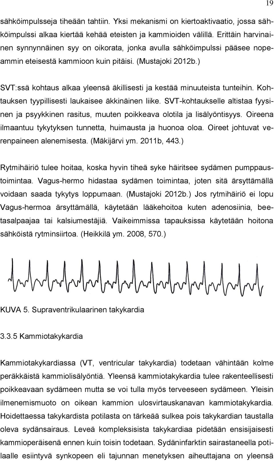 ) SVT:ssä kohtaus alkaa yleensä äkillisesti ja kestää minuuteista tunteihin. Kohtauksen tyypillisesti laukaisee äkkinäinen liike.