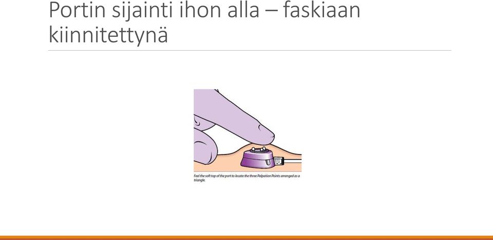 ihon alla