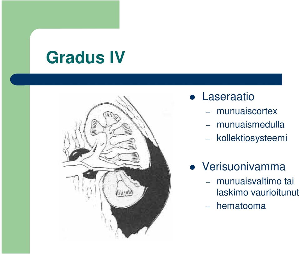 kollektiosysteemi Verisuonivamma