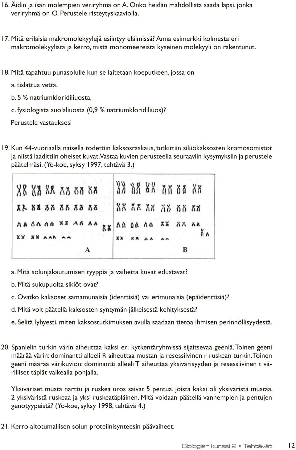 5 % natriumkloridiliuosta, c. fysiologista suolaliuosta (0,9 % natriumkloridiliuos)? Perustele vastauksesi 19.