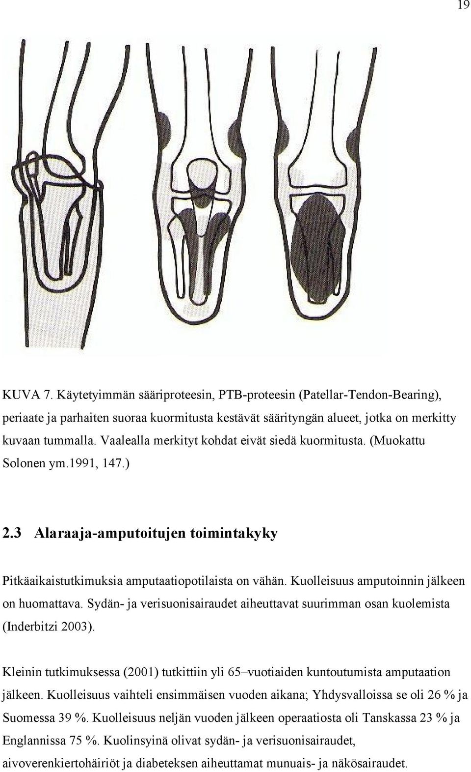 Kuolleisuus amputoinnin jälkeen on huomattava. Sydän- ja verisuonisairaudet aiheuttavat suurimman osan kuolemista (Inderbitzi 2003).