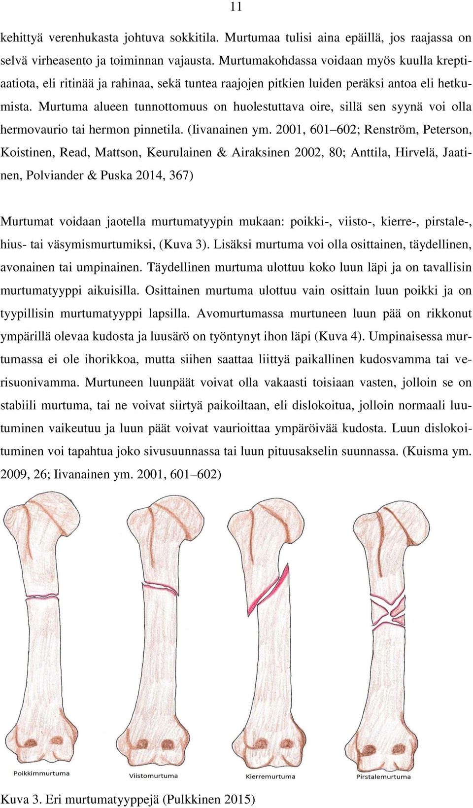 Murtuma alueen tunnottomuus on huolestuttava oire, sillä sen syynä voi olla hermovaurio tai hermon pinnetila. (Iivanainen ym.