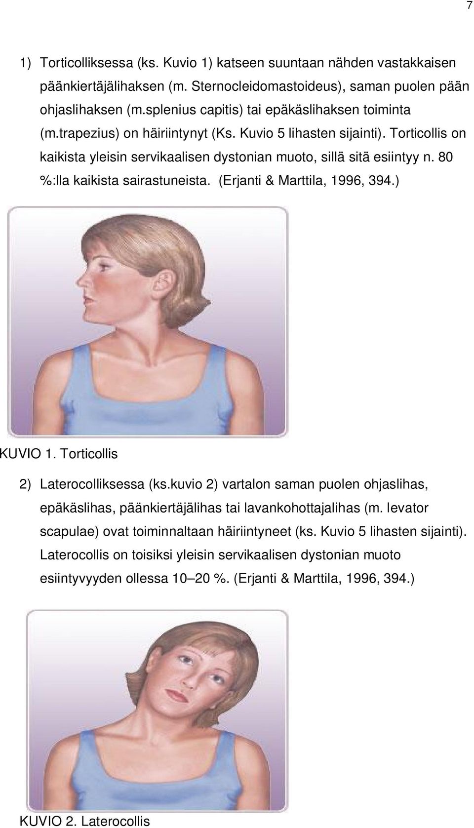 80 %:lla kaikista sairastuneista. (Erjanti & Marttila, 1996, 394.) KUVIO 1. Torticollis 2) Laterocolliksessa (ks.