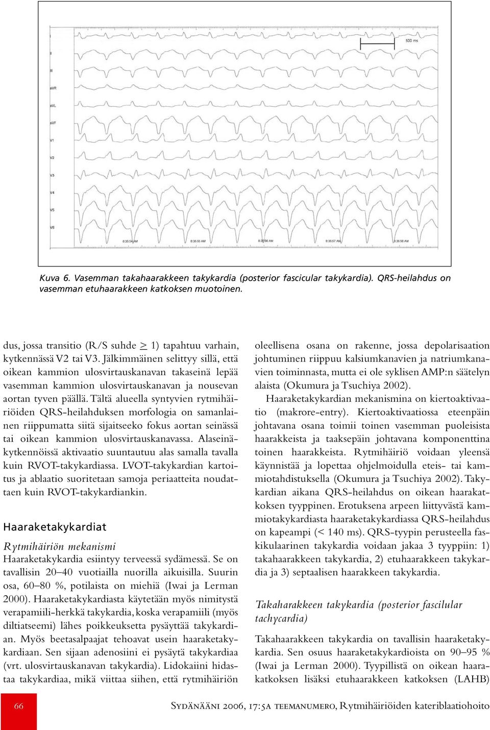 dus, jossa transitio (R/S suhde > 1) tapahtuu varhain, kytkennässä V2 tai V3.