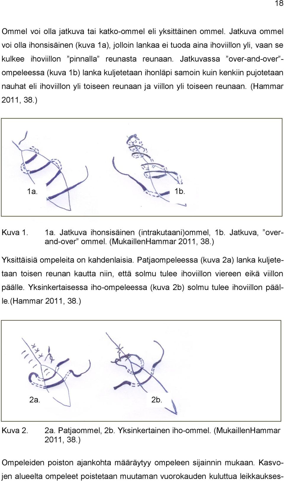 Jatkuvassa over-and-over - ompeleessa (kuva 1b) lanka kuljetetaan ihonläpi samoin kuin kenkiin pujotetaan nauhat eli ihoviillon yli toiseen reunaan ja viillon yli toiseen reunaan. (Hammar 2011, 38.