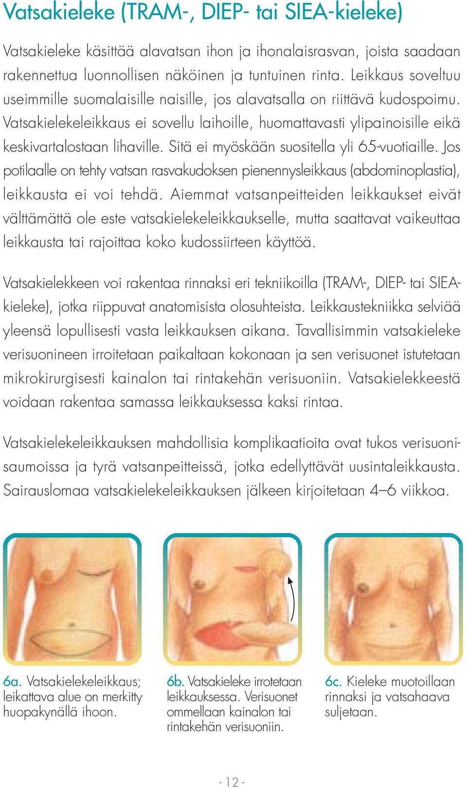 Sitä ei myöskään suositella yli 65-vuotiaille. Jos potilaalle on tehty vatsan rasvakudoksen pienennysleikkaus (abdominoplastia), leikkausta ei voi tehdä.