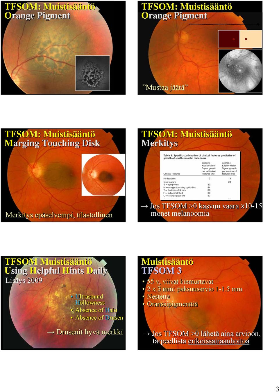 Helpful Hints Daily Lisäys 2009 Ultrasound Hollowness Absence of Halo Absence of Drusen Drusenit hyvä merkki Muistisääntö TFSOM 3 55 v,