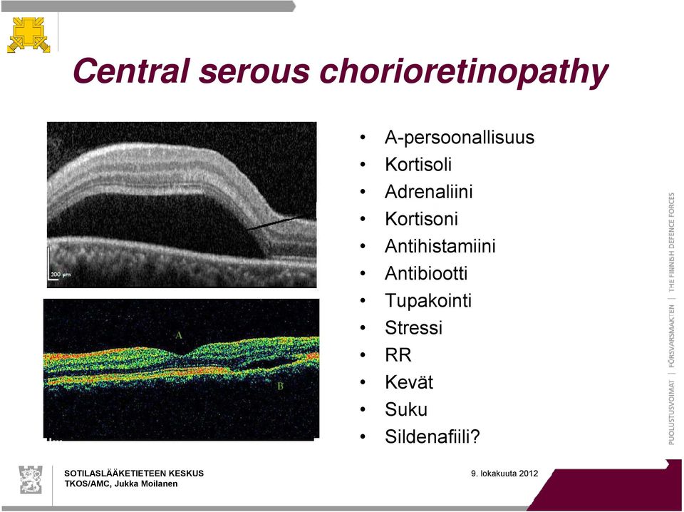 Kortisoni Antihistamiini Antibiootti