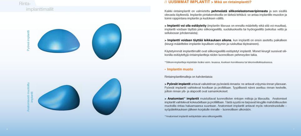 Pyöreä implantti > Implantti voi olla esitäytetty (implantin tilavuus on ennalta määritelty eikä sitä voi muuttaa), implantti voidaan täyttää joko silikonigeelillä, suolaliuoksella tai hydrogeelillä