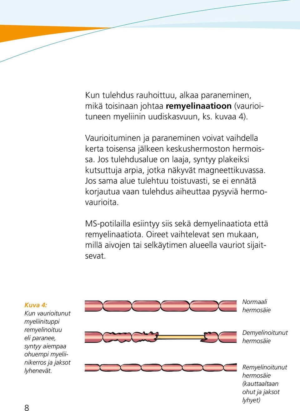 Jos sama alue tulehtuu toistuvasti, se ei ennätä korjautua vaan tulehdus aiheuttaa pysyviä hermovaurioita. MS-potilailla esiintyy siis sekä demyelinaatiota että remyelinaatiota.