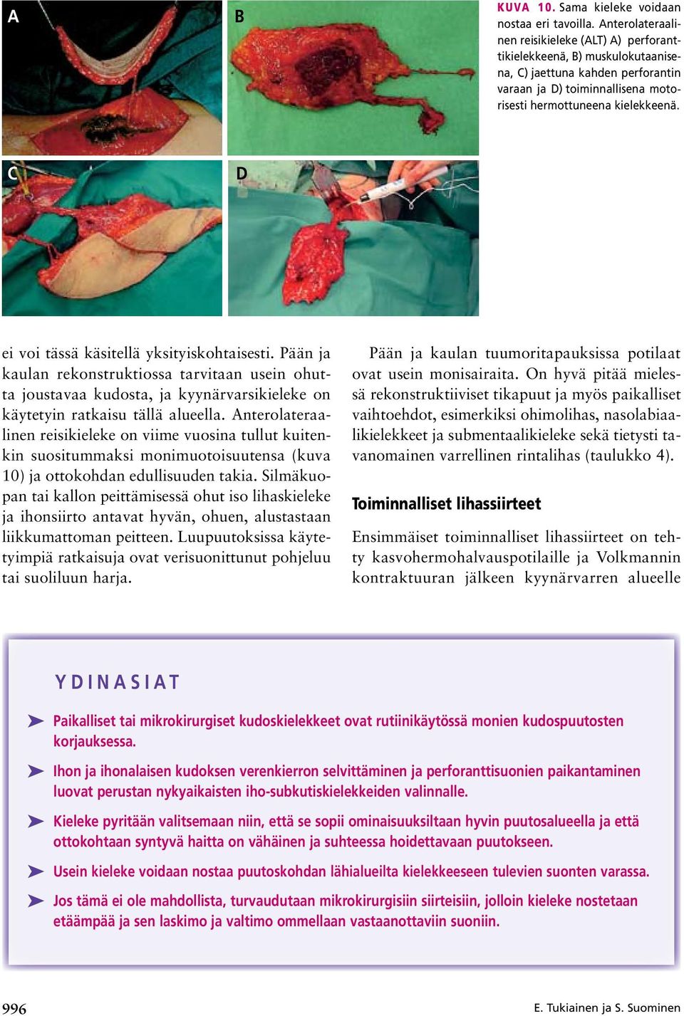 C D ei voi tässä käsitellä yksityiskohtaisesti. Pään ja kaulan rekonstruktiossa tarvitaan usein ohutta joustavaa kudosta, ja kyynärvarsikieleke on käytetyin ratkaisu tällä alueella.