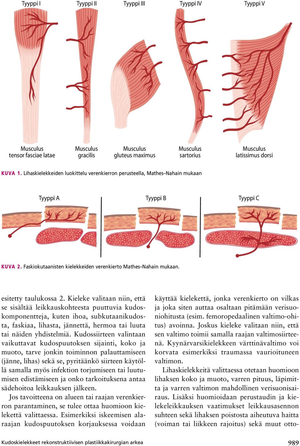 Kieleke valitaan niin, että se sisältää leikkauskohteesta puuttuvia kudoskomponentteja, kuten ihoa, subkutaanikudosta, faskiaa, lihasta, jännettä, hermoa tai luuta tai näiden yhdistelmiä.