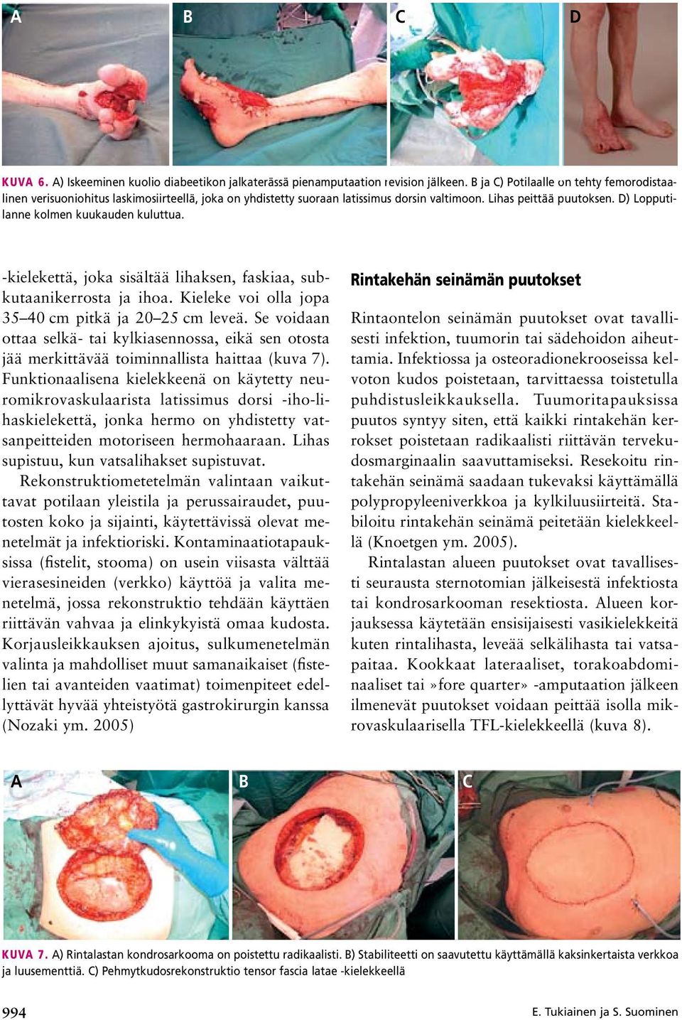 D) Lopputilanne kolmen kuukauden kuluttua. kielekettä, joka sisältää lihaksen, faskiaa, subkutaanikerrosta ja ihoa. Kieleke voi olla jopa 35 40 cm pitkä ja 20 25 cm leveä.