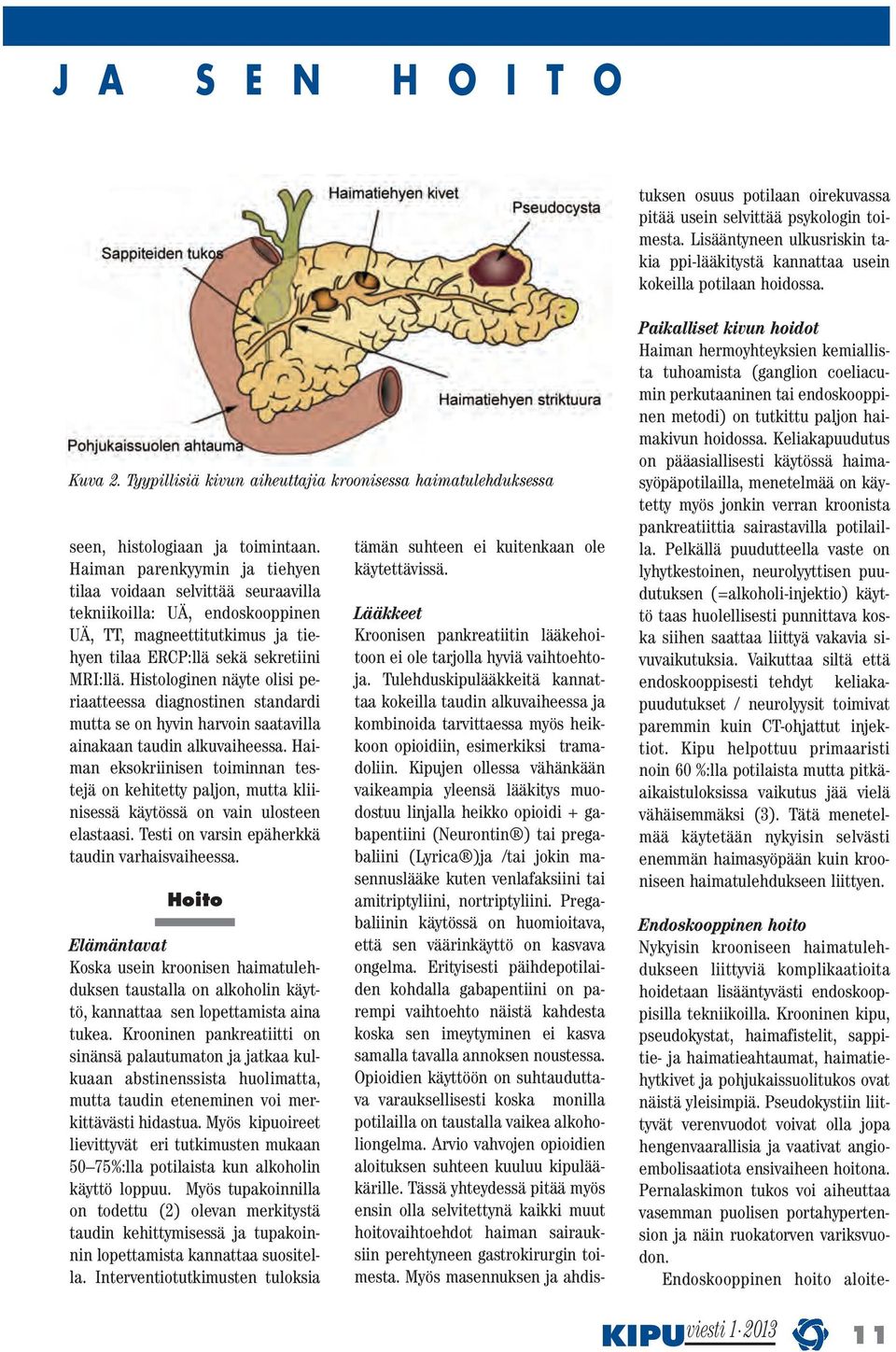 Kipujen ollessa vähänkään vaikeampia yleensä lääkitys muodostuu linjalla heikko opioidi + gabapentiini (Neurontin ) tai pregabaliini (Lyrica )ja /tai jokin masennuslääke kuten venlafaksiini tai