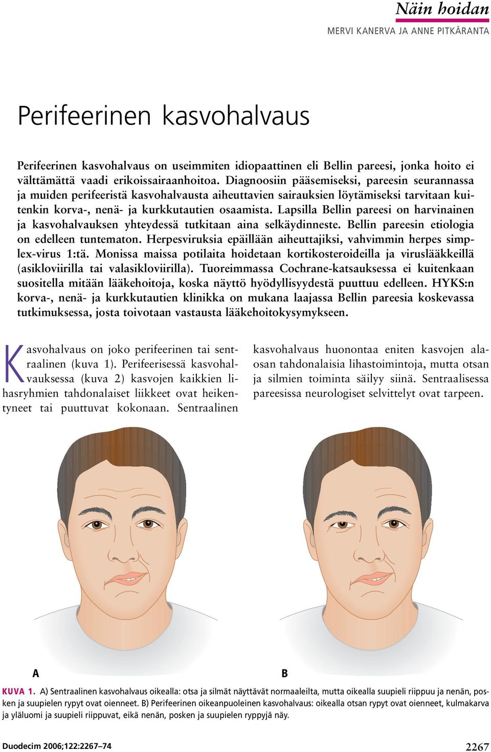 Lapsilla Bellin pareesi on harvinainen ja kasvohalvauksen yhteydessä tutkitaan aina selkäydinneste. Bellin pareesin etiologia on edelleen tuntematon.