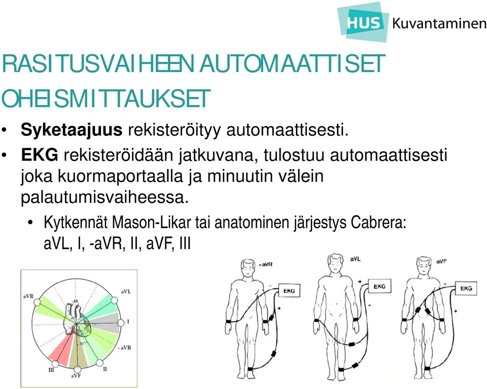 EKG rekisteröidään jatkuvana, tulostuu automaattisesti joka