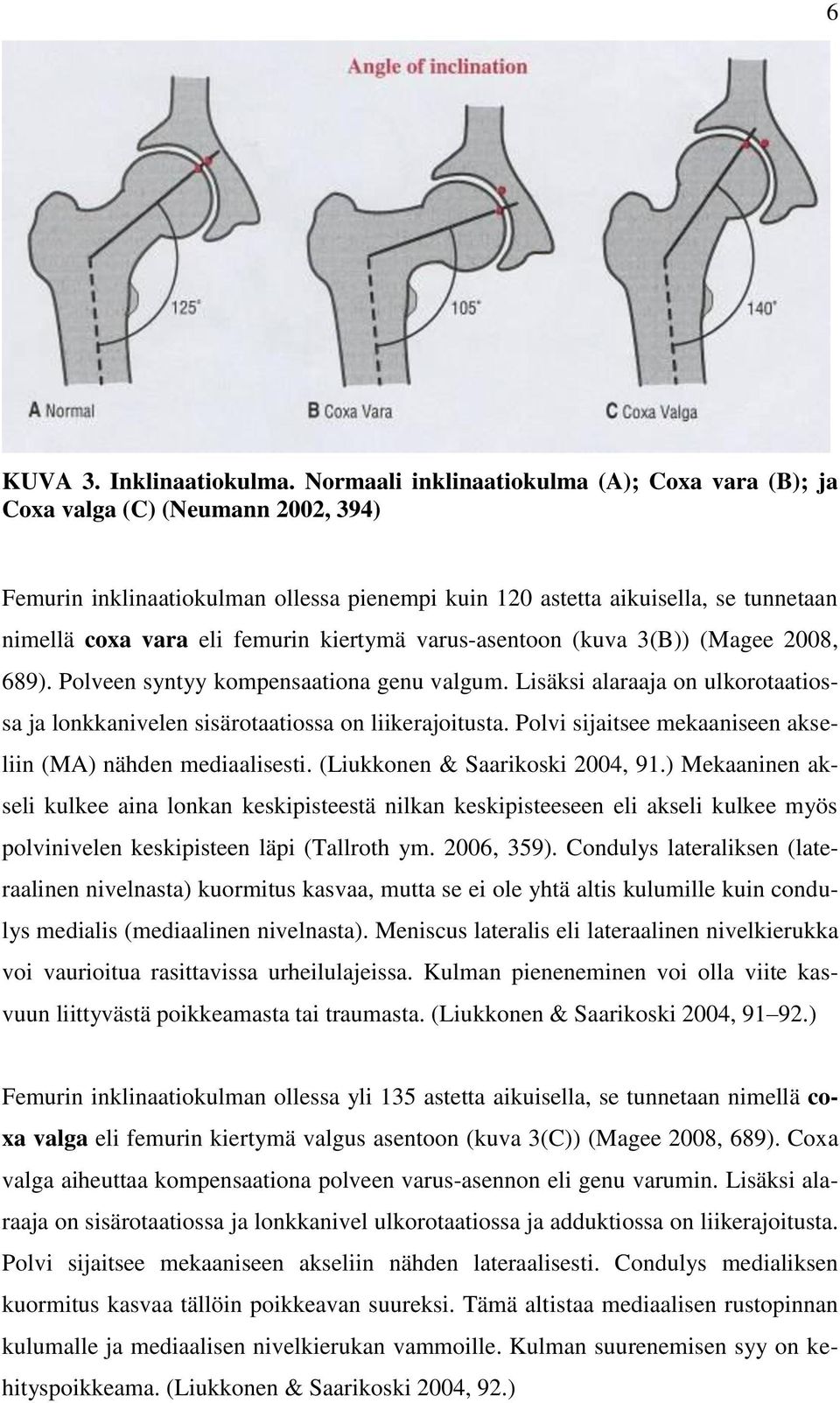 kiertymä varus-asentoon (kuva 3(B)) (Magee 2008, 689). Polveen syntyy kompensaationa genu valgum. Lisäksi alaraaja on ulkorotaatiossa ja lonkkanivelen sisärotaatiossa on liikerajoitusta.