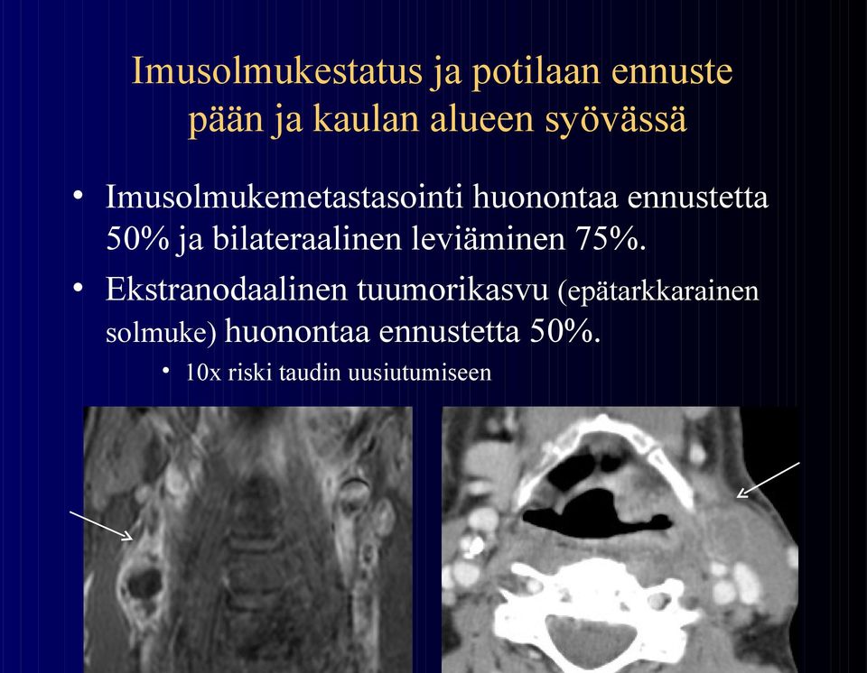 bilateraalinen leviäminen 75%.