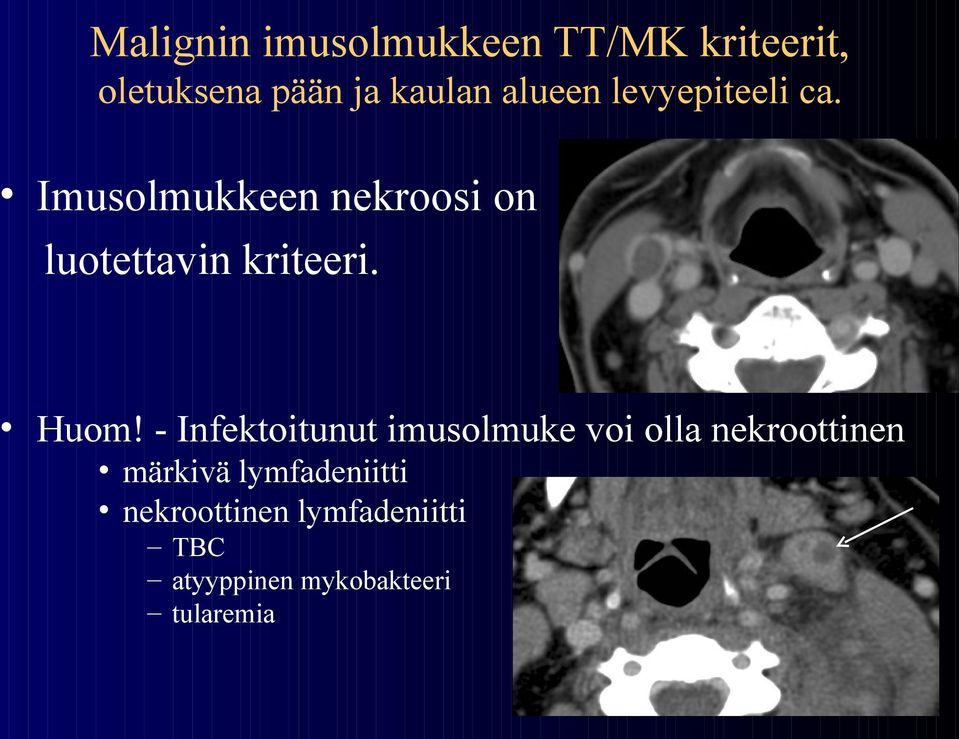 Imusolmukkeen nekroosi on luotettavin kriteeri. Huom!