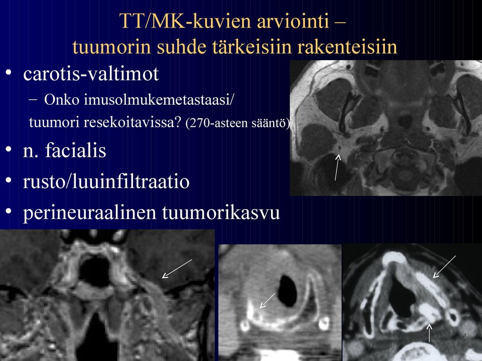 imusolmukemetastaasi/ tuumori resekoitavissa?