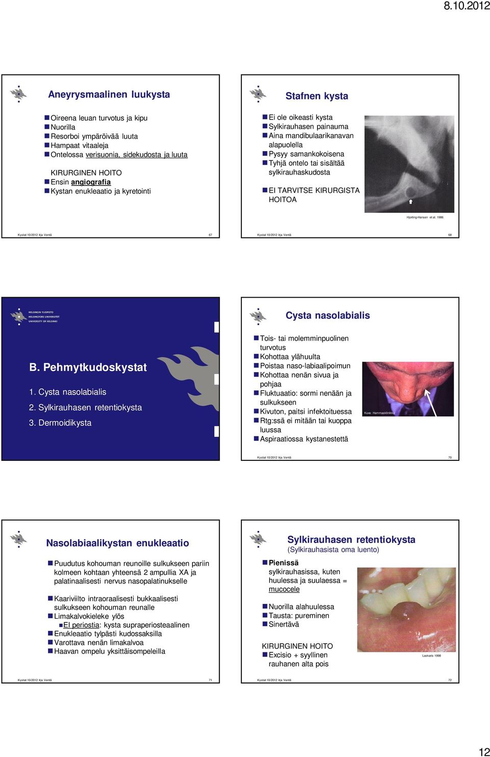 KIRURGISTA HOITOA Hjorting-Hansen et al. 1986 67 68 Cysta nasolabialis B. Pehmytkudoskystat 1. Cysta nasolabialis 2. Sylkirauhasen retentiokysta 3.