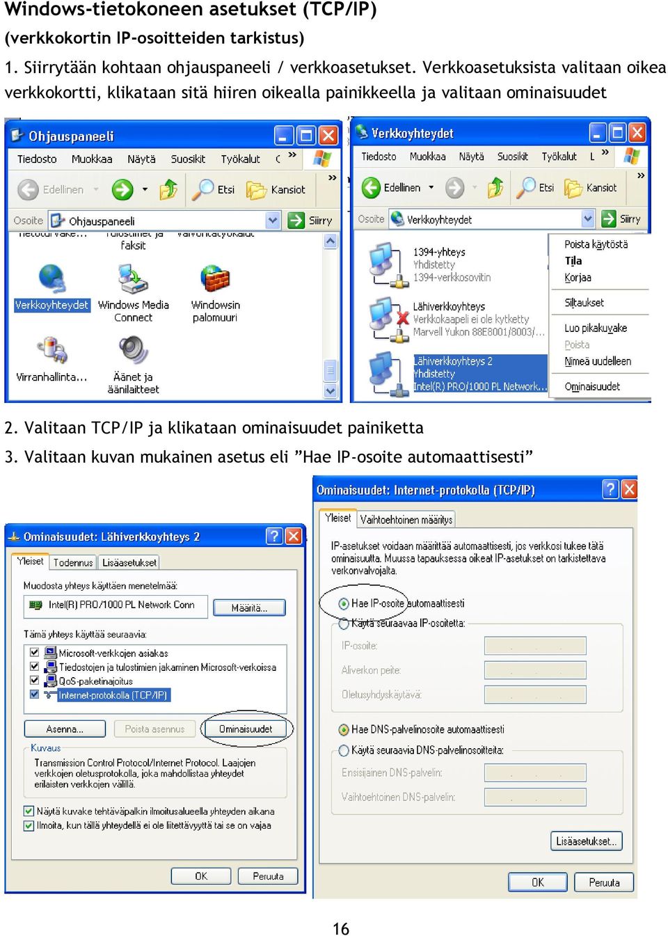Verkkoasetuksista valitaan oikea verkkokortti, klikataan sitä hiiren oikealla painikkeella ja