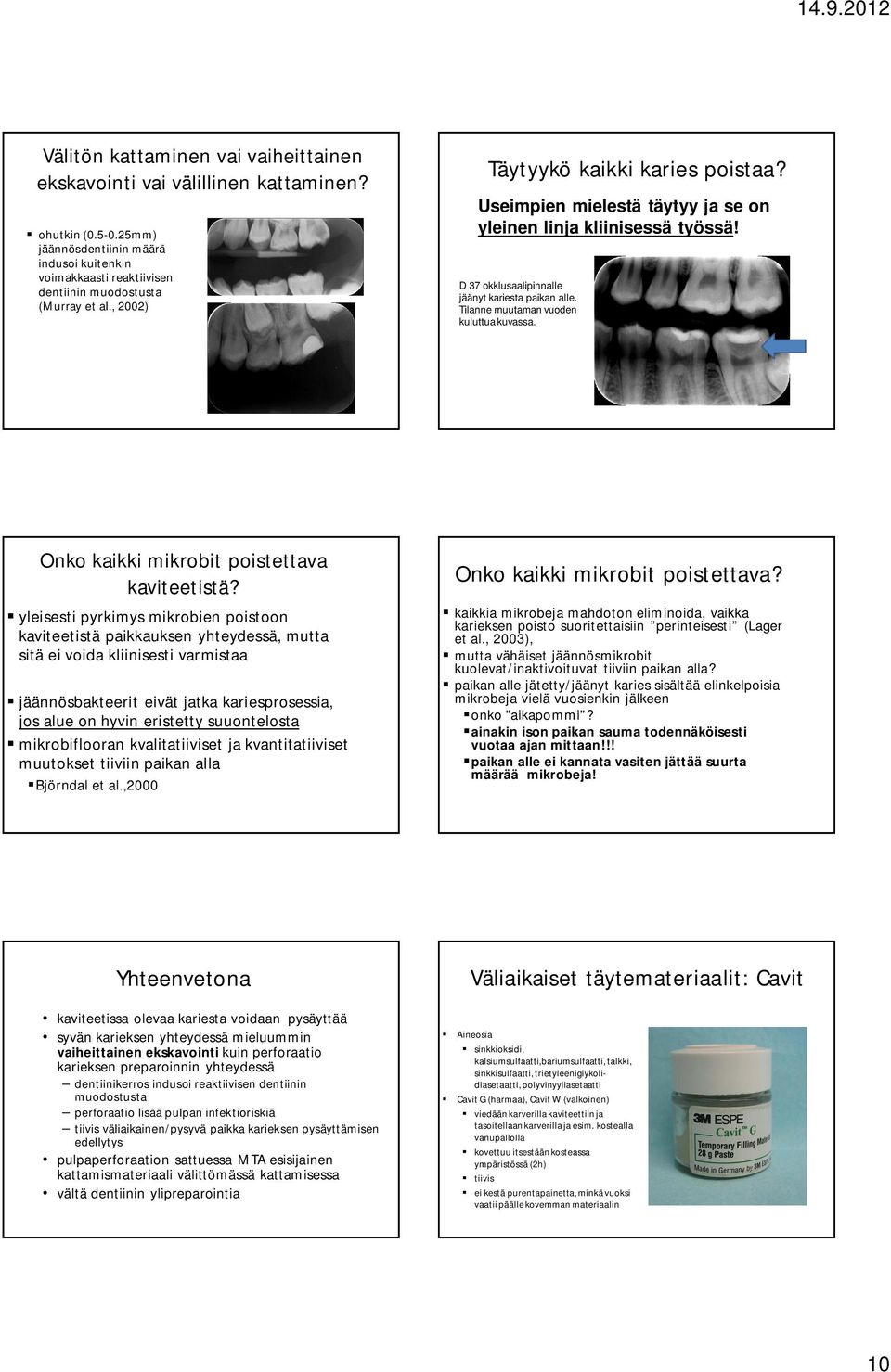 Tilanne muutaman vuoden kuluttua kuvassa. Onko kaikki mikrobit poistettava kaviteetistä?