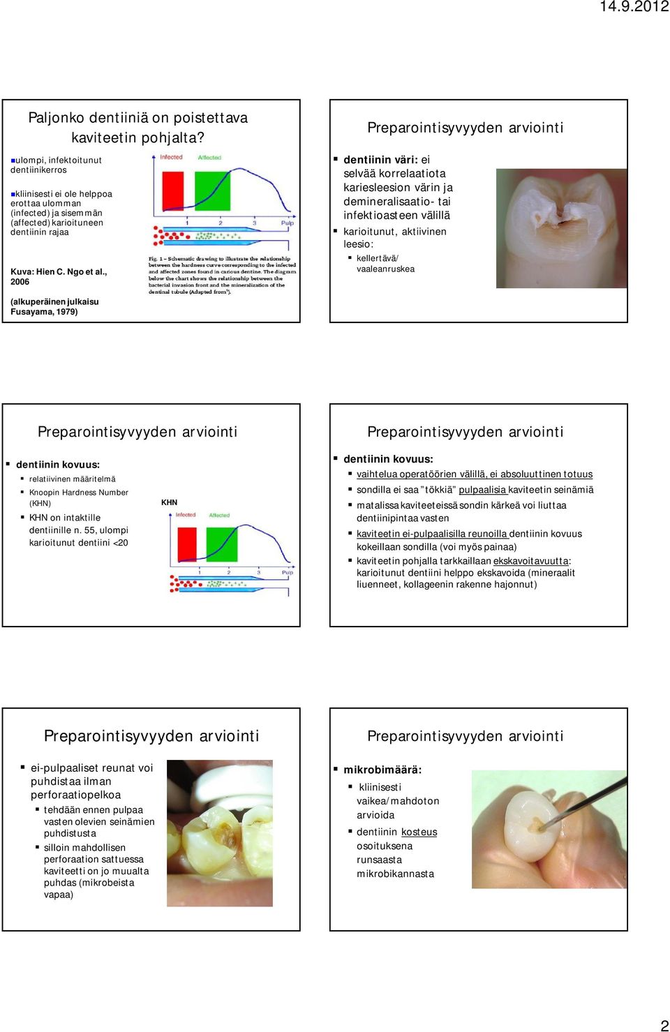 , 2006 dentiinin väri: ei selvää korrelaatiota kariesleesion värin ja demineralisaatio- tai infektioasteen välillä karioitunut, aktiivinen leesio: kellertävä/ vaaleanruskea (alkuperäinen julkaisu