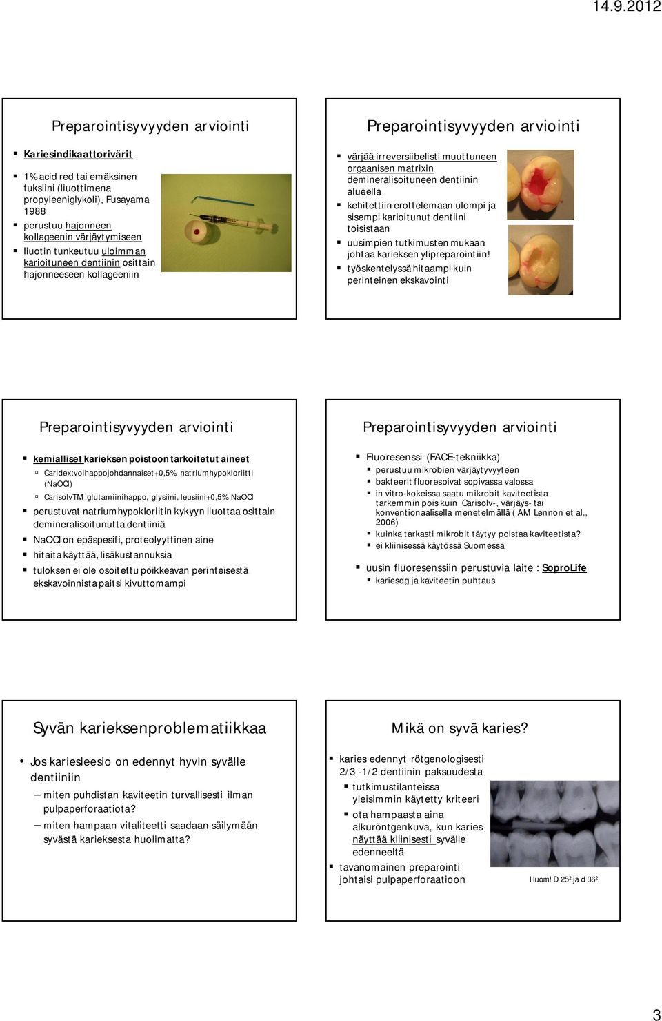 dentiini toisistaan uusimpien tutkimusten mukaan johtaa karieksen ylipreparointiin!