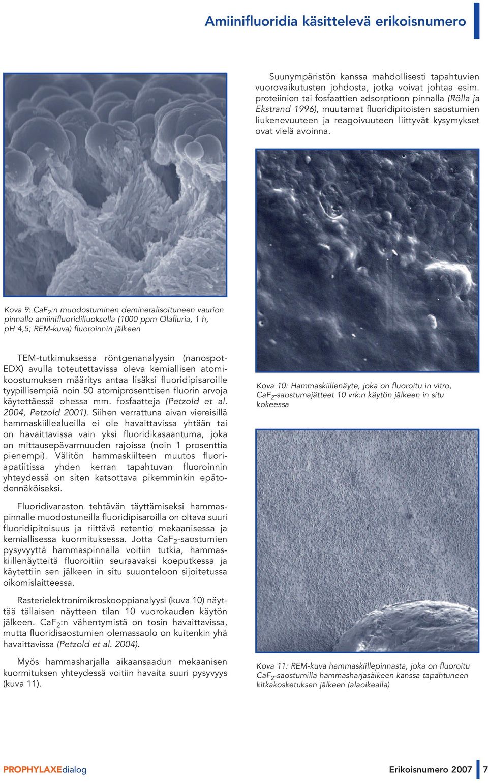 Kova 9: CaF 2 :n muodostuminen demineralisoituneen vaurion pinnalle amiinifluoridiliuoksella (1000 ppm Olafluria, 1 h, ph 4,5; REM-kuva) fluoroinnin jälkeen TEM-tutkimuksessa röntgenanalyysin