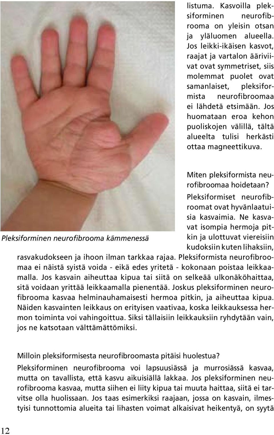 Jos huomataan eroa kehon puoliskojen välillä, tältä alueelta tulisi herkästi ottaa magneettikuva. Miten pleksiformista neurofibroomaa hoidetaan?