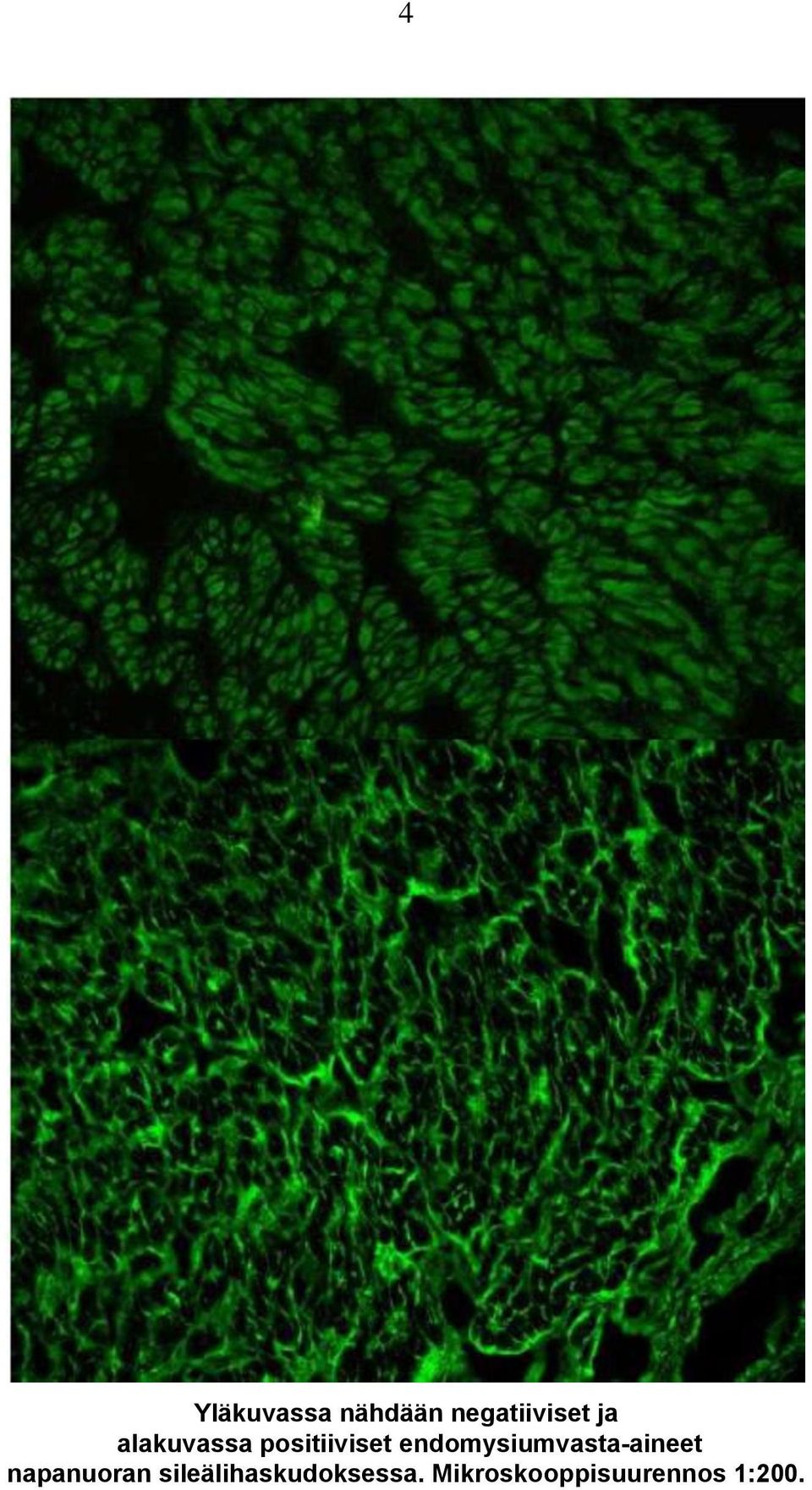 endomysiumvasta-aineet napanuoran