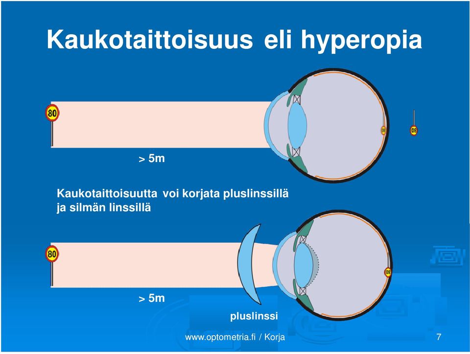 Kaukotaittoisuutta voi