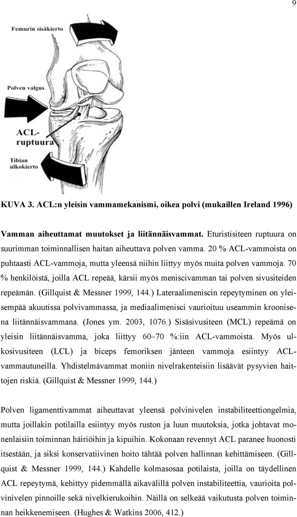 70 % henkilöistä, joilla ACL repeää, kärsii myös meniscivamman tai polven sivusiteiden repeämän. (Gillquist & Messner 1999, 144.