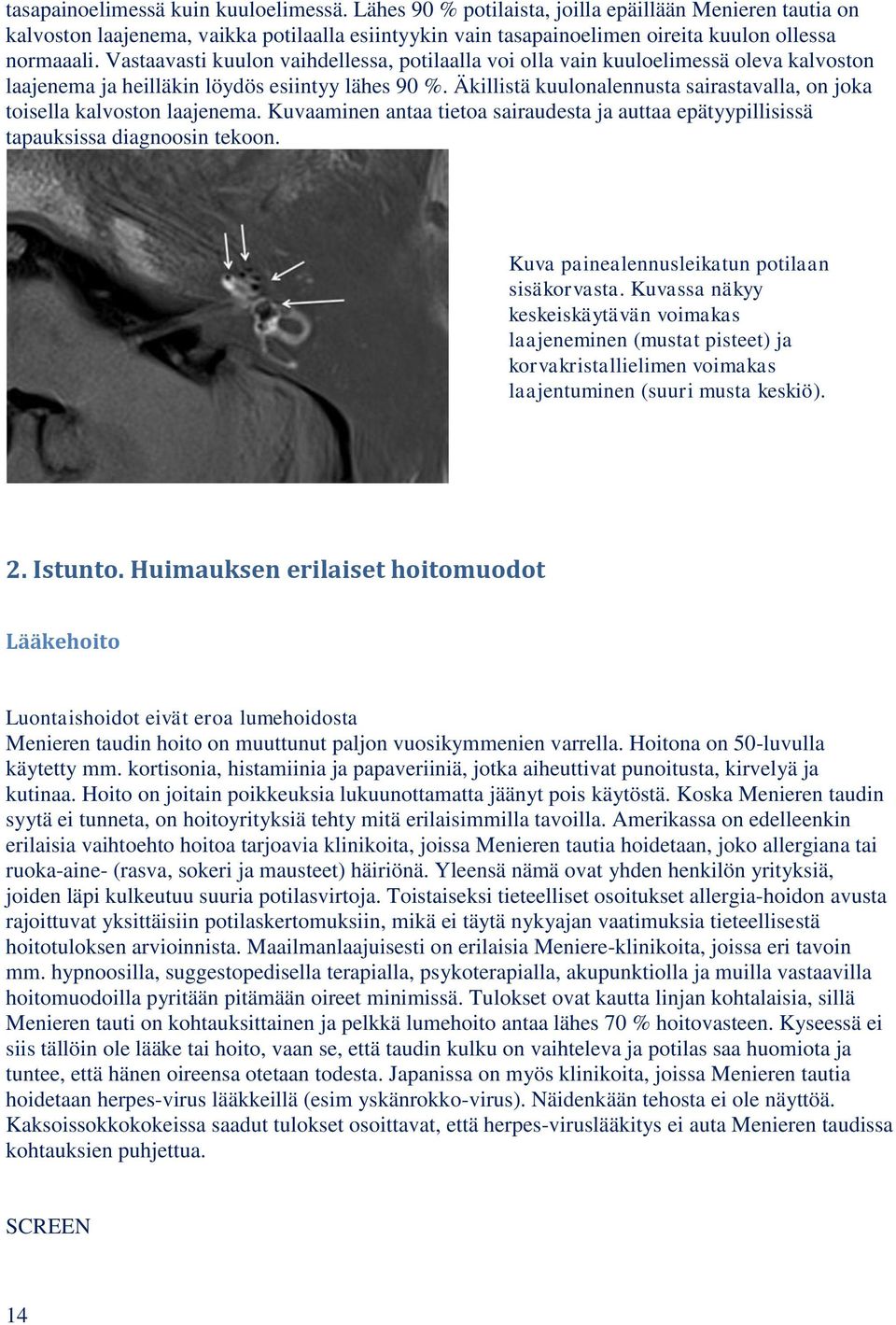 Vastaavasti kuulon vaihdellessa, potilaalla voi olla vain kuuloelimessä oleva kalvoston laajenema ja heilläkin löydös esiintyy lähes 90 %.