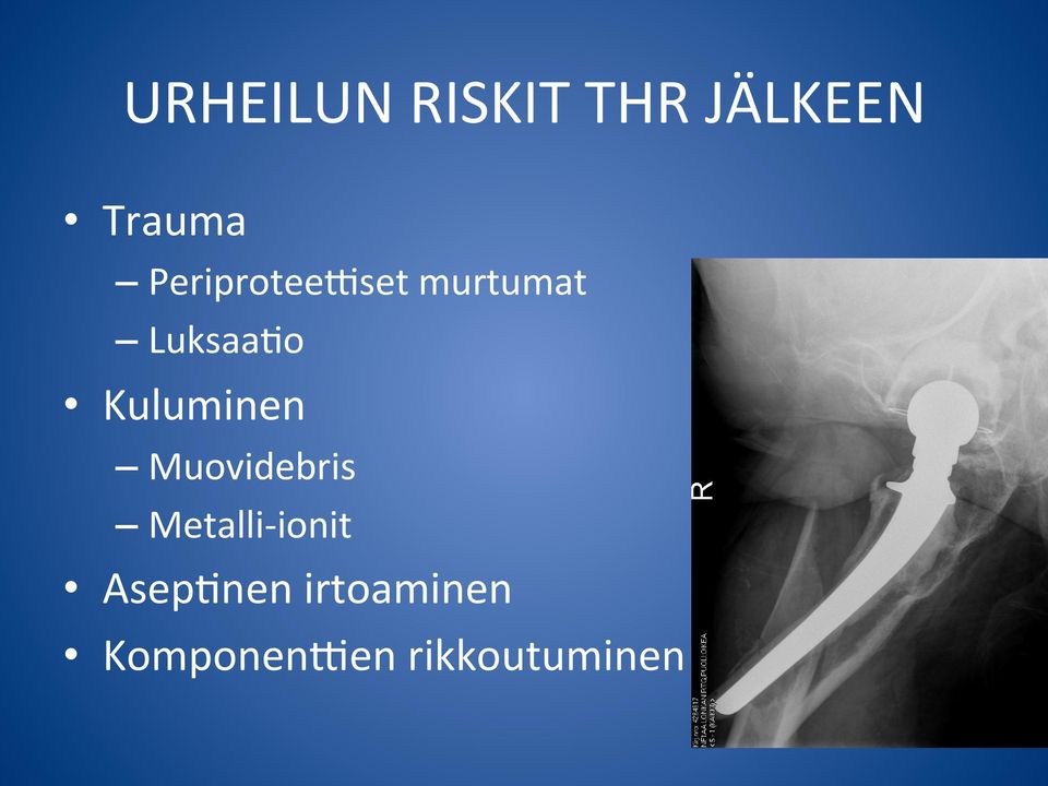 Kuluminen Muovidebris Metalli- ionit