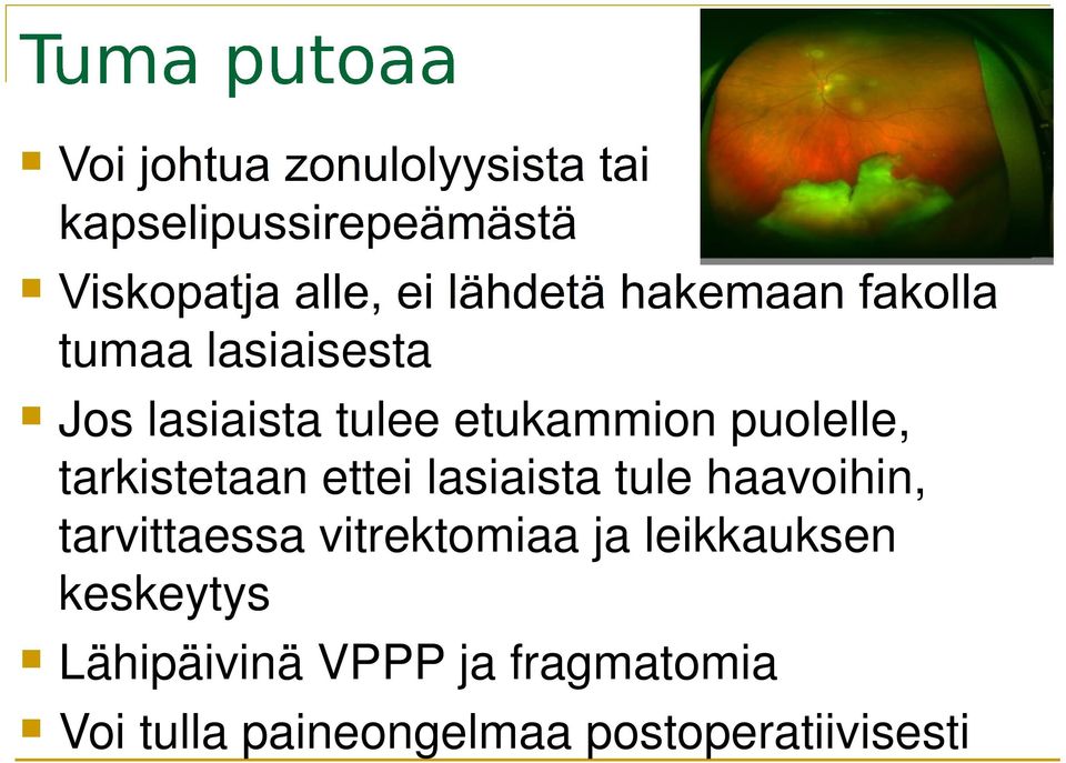 tarvittaessa vitrektomiaa ja leikkauksen keskeytys