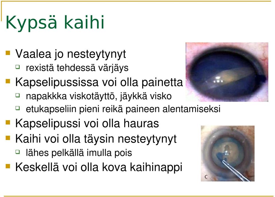 reikä paineen alentamiseksi Kapselipussi voi olla hauras Kaihi voi olla