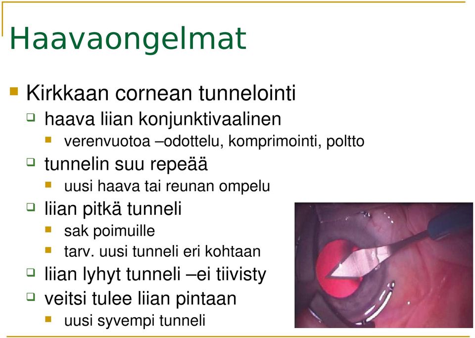 reunan ompelu liian pitkä tunneli sak poimuille tarv.