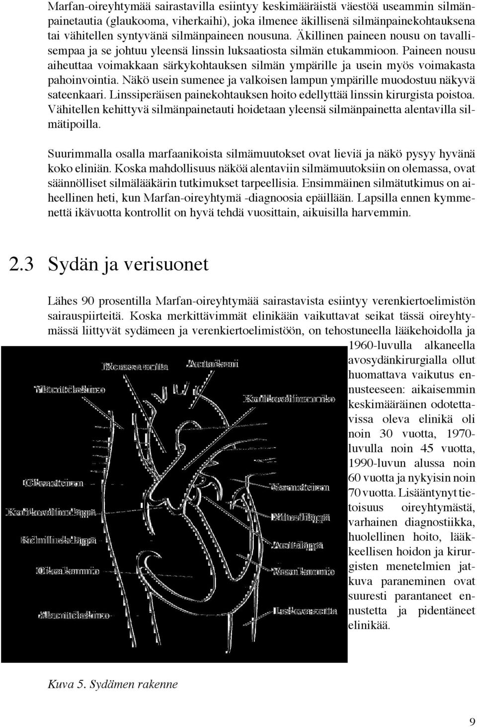 Paineen nousu aiheuttaa voimakkaan särkykohtauksen silmän ympärille ja usein myös voimakasta pahoinvointia. Näkö usein sumenee ja valkoisen lampun ympärille muodostuu näkyvä sateenkaari.