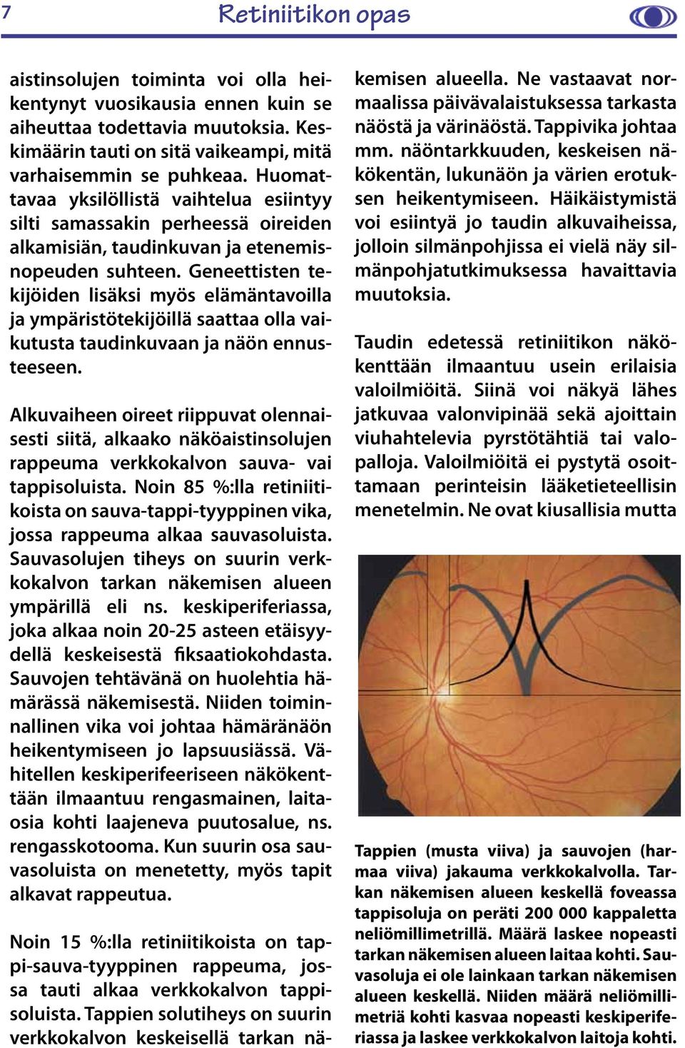 Geneettisten tekijöiden lisäksi myös elämäntavoilla ja ympäristötekijöillä saattaa olla vaikutusta taudinkuvaan ja näön ennusteeseen.