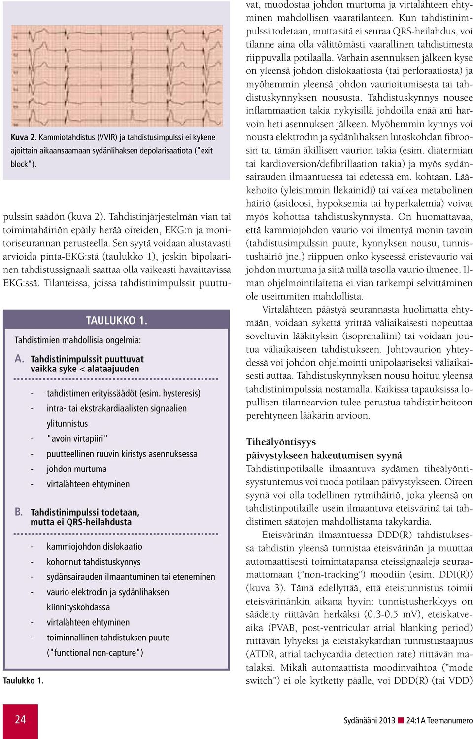 hysteresis) - intra- tai ekstrakardiaalisten signaalien ylitunnistus - "avoin virtapiiri" - puutteellinen ruuvin kiristys asennuksessa - johdon murtuma - virtalähteen ehtyminen B.