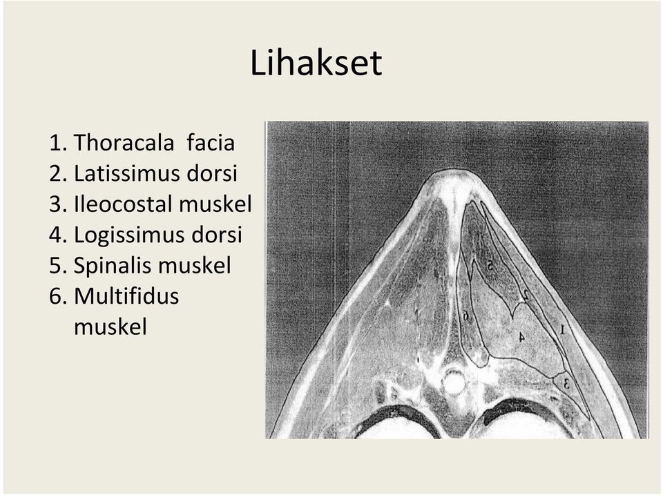 Ileocostal muskel 4.