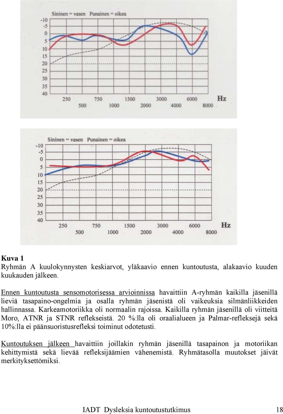 Karkeamotoriikka oli normaalin rajoissa. Kaikilla ryhmän jäsenillä oli viitteitä Moro, ATNR ja STNR reflekseistä.