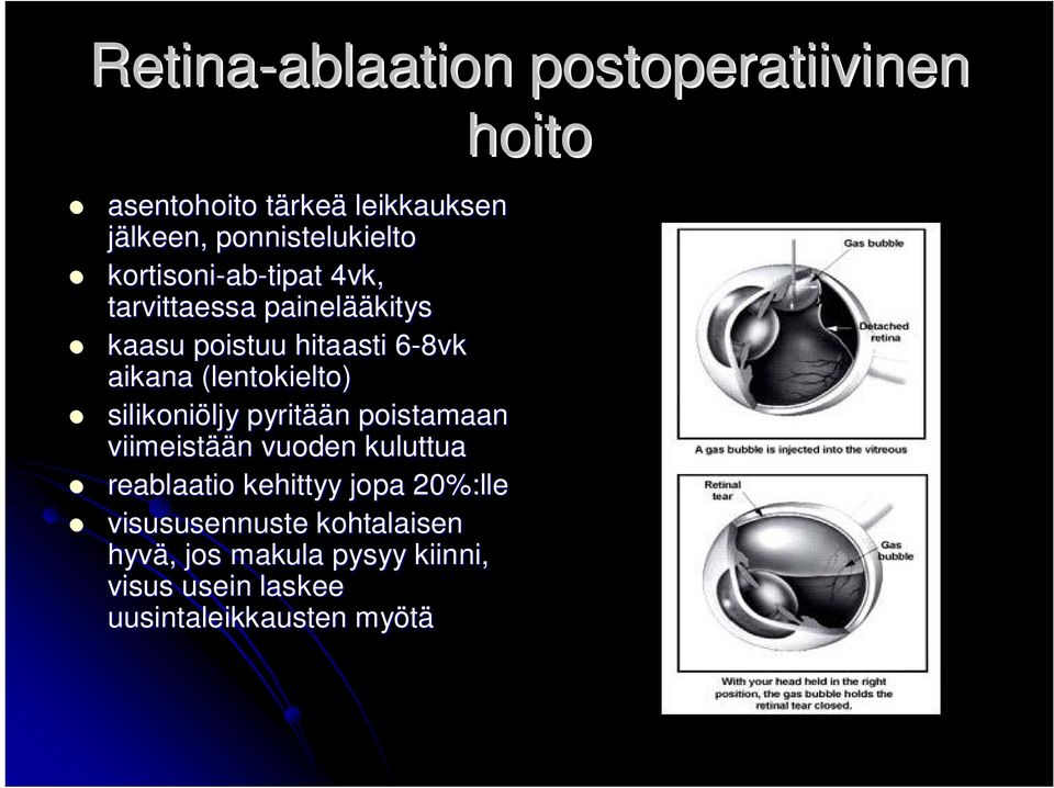 (lentokielto) silikoniöljy ljy pyritää ään poistamaan viimeistää ään vuoden kuluttua reablaatio kehittyy