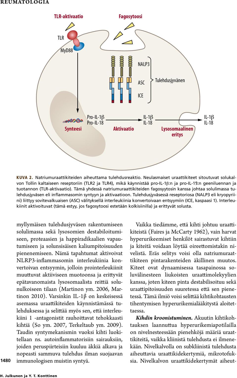 Neulasmaiset uraattikiteet sitoutuvat solukalvon Tollin kaltaiseen reseptoriin (TLR2 ja TLR4), mikä käynnistää pro-il-1b:n ja pro-il-18:n geeniluennan ja tuotannon (TLR-aktivaatio).