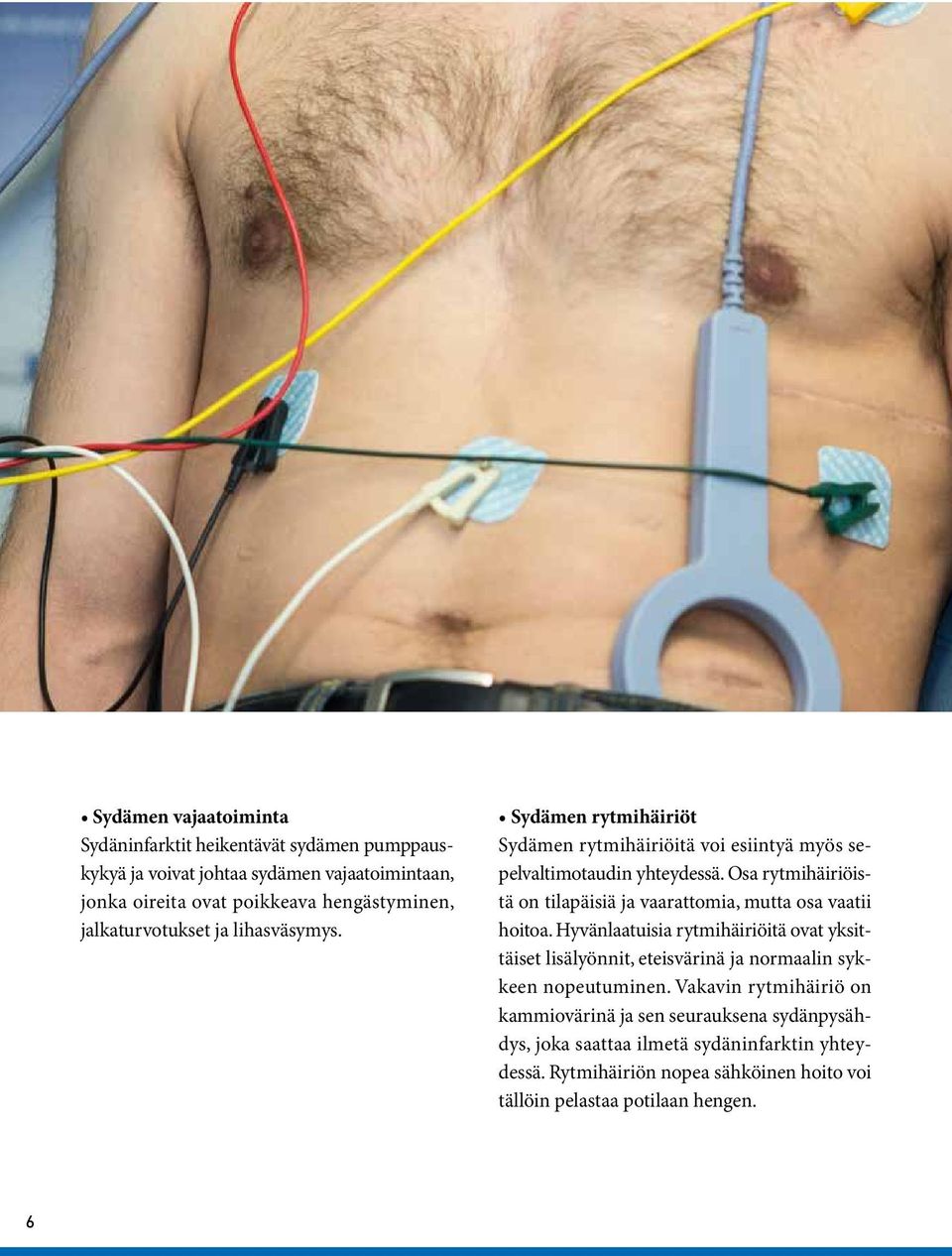 Osa rytmihäiriöistä on tilapäisiä ja vaarattomia, mutta osa vaatii hoitoa.