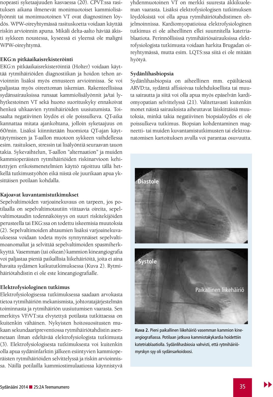 EKG:n pitkäaikaisrekisteröinti EKG:n pitkäaikaisrekisteröintiä (Holter) voidaan käyttää rytmihäiriöiden diagnostiikan ja hoidon tehon arvioinnin lisäksi myös ennusteen arvioinnissa.