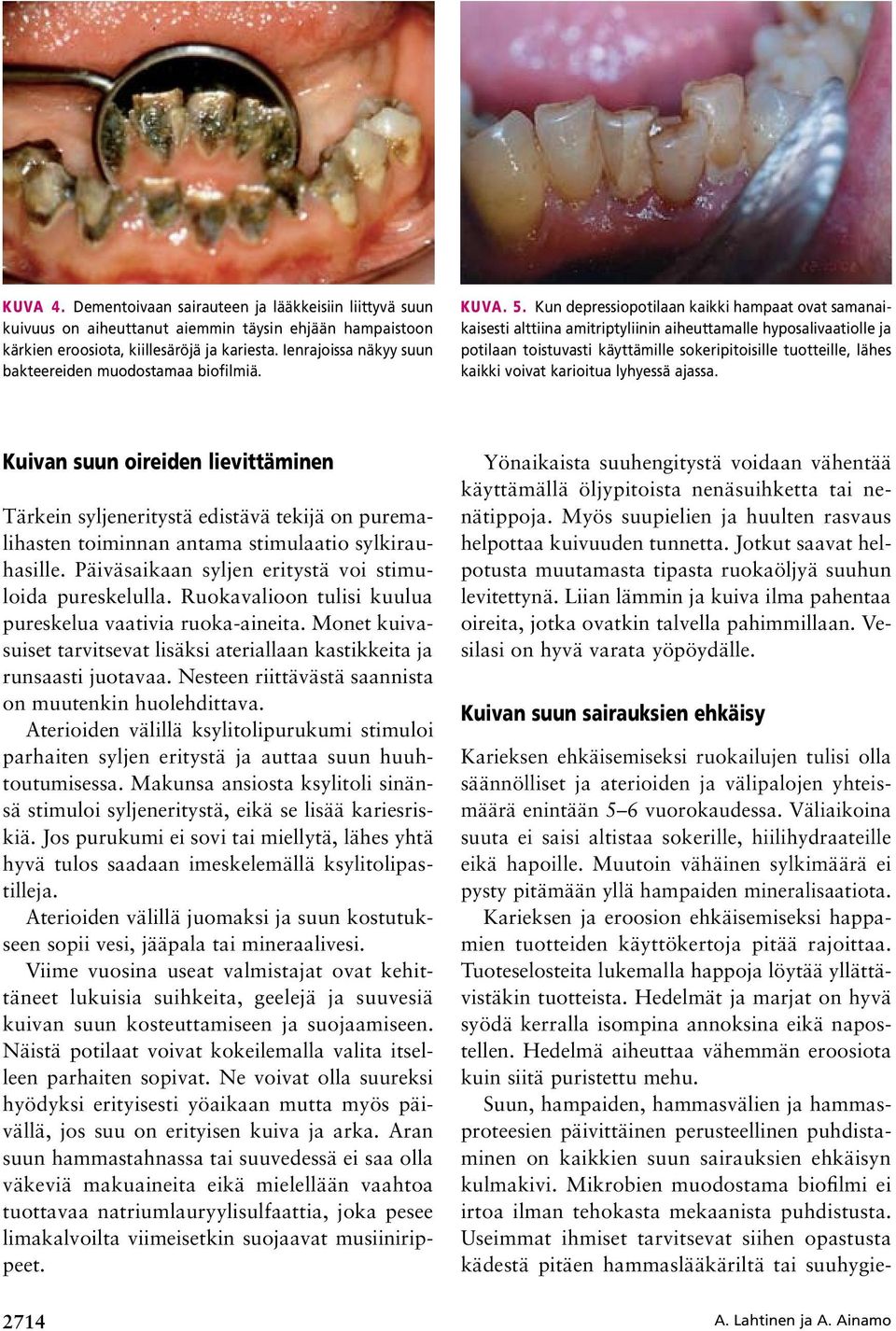 Kun depressiopotilaan kaikki hampaat ovat samanaikaisesti alttiina amitriptyliinin aiheuttamalle hyposalivaatiolle ja potilaan toistuvasti käyttämille sokeripitoisille tuotteille, lähes kaikki voivat