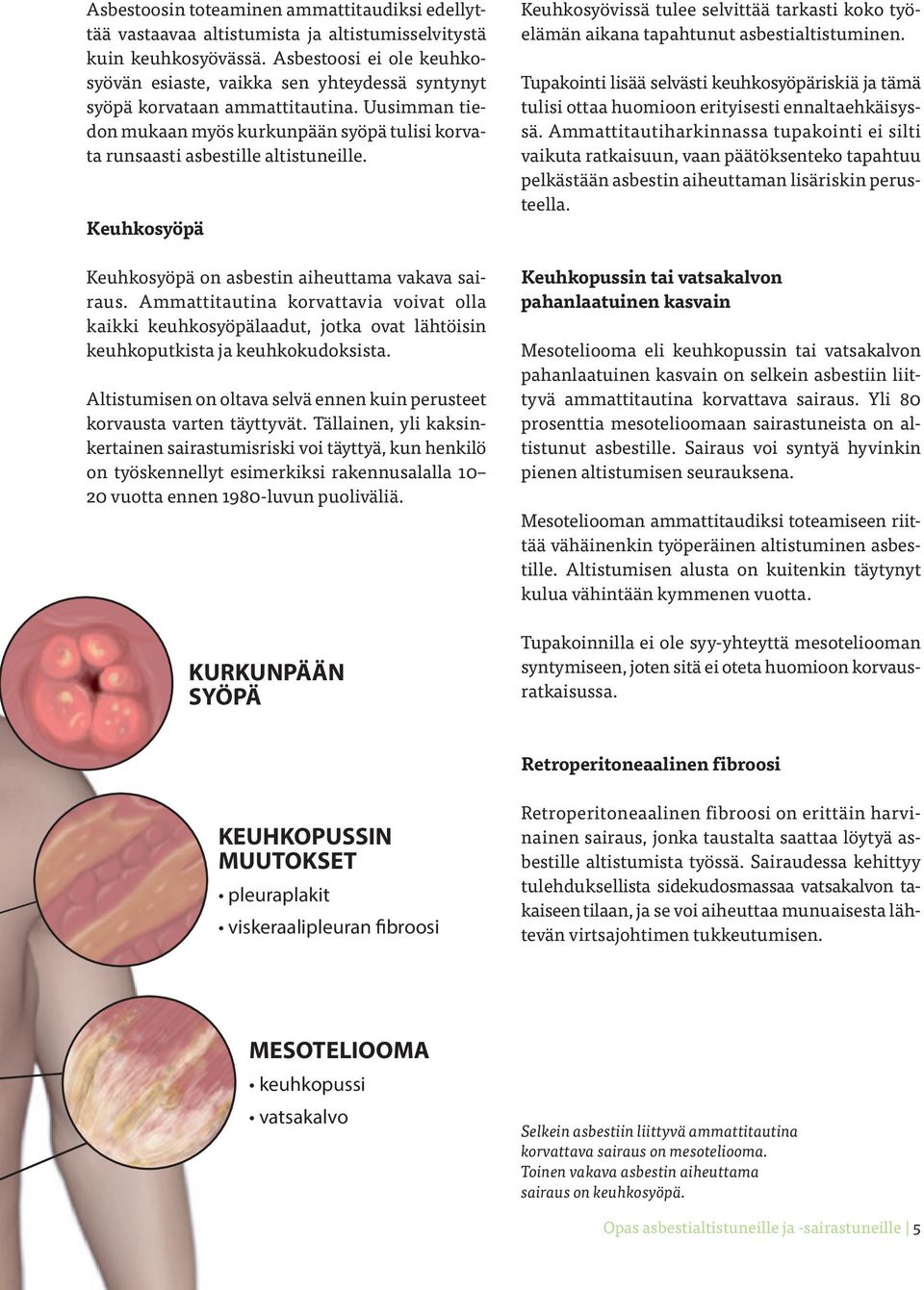 Keuhkosyöpä Keuhkosyöpä on asbestin aiheuttama vakava sairaus. Ammattitautina korvattavia voivat olla kaikki keuhkosyöpälaadut, jotka ovat lähtöisin keuhkoputkista ja keuhkokudoksista.